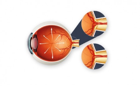 Grüner Star Zeichnung